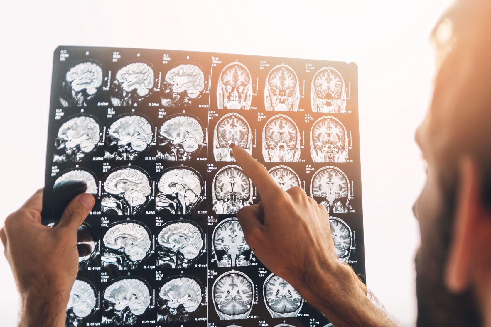 Un médecin examine les résultats d'une radio ou d'une IRM